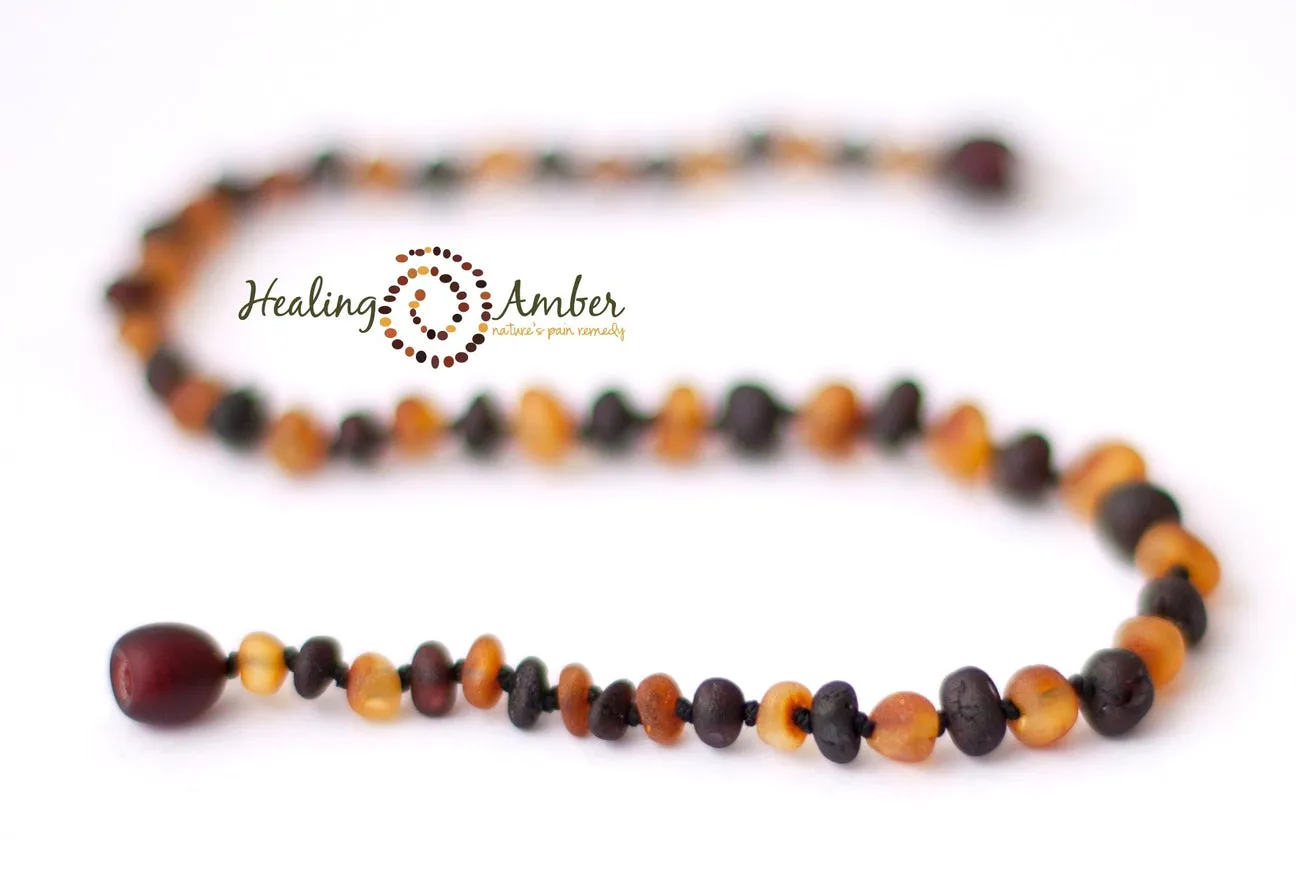 Healing Amber Raw Necklace - 13"