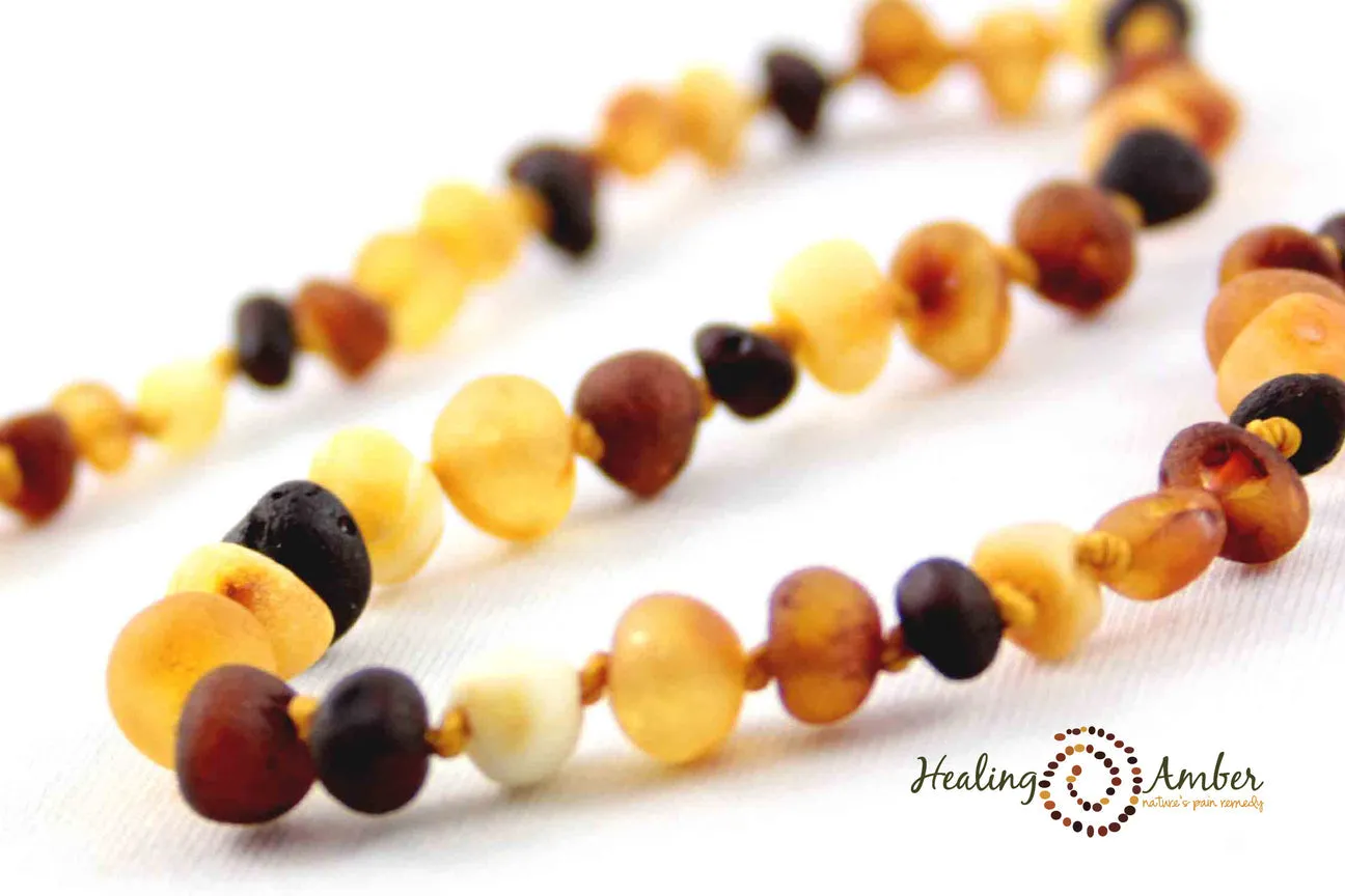 Healing Amber Raw Necklace - 13"