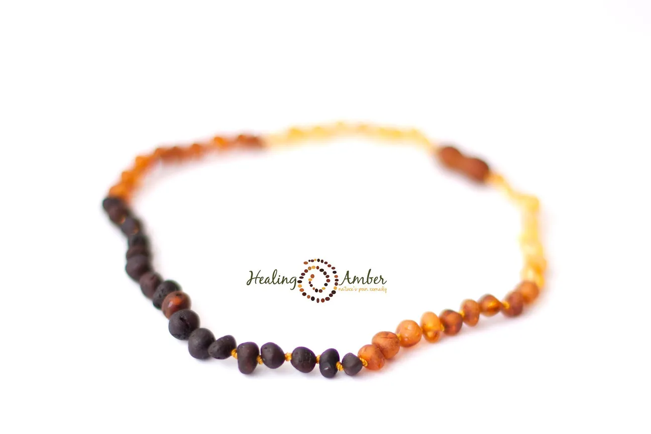 Healing Amber Raw Necklace - 13"