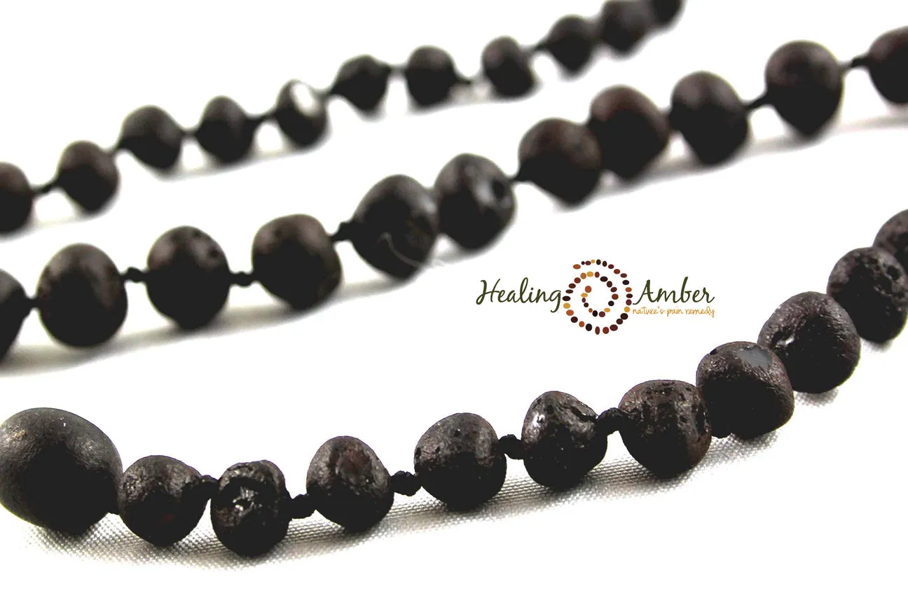 Healing Amber Raw Necklace - 13"